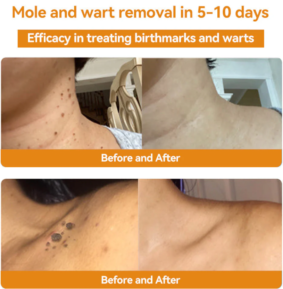 Bee Venom Skin Treatment